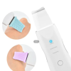 Espátula Limpieza Facial Ultrasónico Exfoliante Recargable